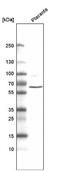 Adhesion G Protein-Coupled Receptor L4 antibody, NBP2-59041, Novus Biologicals, Western Blot image 