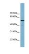 CDK5 Regulatory Subunit Associated Protein 1 antibody, NBP1-58246, Novus Biologicals, Western Blot image 