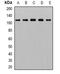 Adaptor Related Protein Complex 2 Subunit Alpha 1 antibody, LS-C482714, Lifespan Biosciences, Western Blot image 