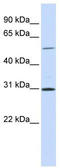 NIMA Related Kinase 3 antibody, TA330982, Origene, Western Blot image 