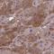 Exocyst Complex Component 6B antibody, HPA063991, Atlas Antibodies, Immunohistochemistry paraffin image 