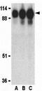Angiotensin I Converting Enzyme 2 antibody, GTX31680, GeneTex, Western Blot image 