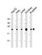 NADH:Ubiquinone Oxidoreductase Subunit B9 antibody, M08623, Boster Biological Technology, Western Blot image 