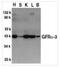 GDNF Family Receptor Alpha 3 antibody, NBP1-77035, Novus Biologicals, Western Blot image 