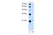 T-complex protein 10A homolog 2 antibody, A10886, Boster Biological Technology, Western Blot image 