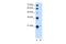 T-Complex 10 Like antibody, A10886, Boster Biological Technology, Western Blot image 