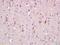 Adenylate Cyclase 1 antibody, orb5674, Biorbyt, Immunohistochemistry paraffin image 