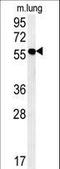 Zinc Finger MYND-Type Containing 10 antibody, LS-C160799, Lifespan Biosciences, Western Blot image 