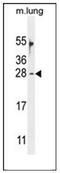 Ornithine Decarboxylase Antizyme 2 antibody, AP52982PU-N, Origene, Western Blot image 