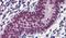 EWS RNA Binding Protein 1 antibody, PA5-19079, Invitrogen Antibodies, Immunohistochemistry paraffin image 