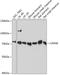 Calpain 9 antibody, GTX66207, GeneTex, Western Blot image 