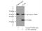 Clathrin Light Chain B antibody, 10455-1-AP, Proteintech Group, Immunoprecipitation image 