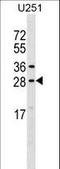 Osteoclast Stimulating Factor 1 antibody, LS-C163282, Lifespan Biosciences, Western Blot image 