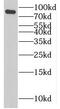 Procollagen-Lysine,2-Oxoglutarate 5-Dioxygenase 3 antibody, FNab06553, FineTest, Western Blot image 