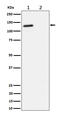 RB Transcriptional Corepressor Like 2 antibody, P02118, Boster Biological Technology, Western Blot image 