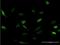Cyclin Dependent Kinase 19 antibody, H00023097-M06, Novus Biologicals, Immunofluorescence image 