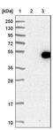 Integrin Subunit Alpha 5 antibody, NBP1-88493, Novus Biologicals, Western Blot image 