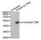Calcium/Calmodulin Dependent Protein Kinase II Alpha antibody, MBS128442, MyBioSource, Western Blot image 