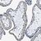 Thrombospondin Type 1 Domain Containing 1 antibody, NBP1-86930, Novus Biologicals, Immunohistochemistry paraffin image 