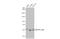 Chaperonin Containing TCP1 Subunit 6A antibody, GTX105148, GeneTex, Western Blot image 