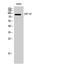 Heterogeneous Nuclear Ribonucleoprotein U Like 2 antibody, A17701, Boster Biological Technology, Western Blot image 