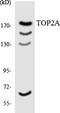 DNA Topoisomerase II Alpha antibody, LS-C292193, Lifespan Biosciences, Western Blot image 