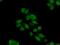 Anti-Silencing Function 1B Histone Chaperone antibody, 11011-1-AP, Proteintech Group, Immunofluorescence image 