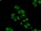 hAsf1b antibody, 11011-1-AP, Proteintech Group, Immunofluorescence image 