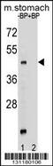 Ghrelin O-acyltransferase antibody, 56-340, ProSci, Western Blot image 