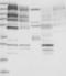 Kinesin Family Member 17 antibody, NBP1-81409, Novus Biologicals, Western Blot image 