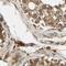 Mitochondrial Ribosomal Protein S22 antibody, PA5-52471, Invitrogen Antibodies, Immunohistochemistry frozen image 