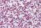 DNA Topoisomerase II Alpha antibody, MBS245817, MyBioSource, Immunohistochemistry paraffin image 