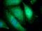 Rho Associated Coiled-Coil Containing Protein Kinase 1 antibody, 21850-1-AP, Proteintech Group, Immunofluorescence image 