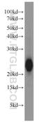 Visinin Like 1 antibody, 13919-1-AP, Proteintech Group, Western Blot image 