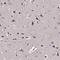 Inositol Polyphosphate-4-Phosphatase Type I A antibody, NBP1-92023, Novus Biologicals, Immunohistochemistry frozen image 