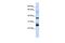 Transmembrane Protein 255A antibody, GTX46314, GeneTex, Western Blot image 