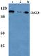 ERCC Excision Repair 4, Endonuclease Catalytic Subunit antibody, A01993-1, Boster Biological Technology, Western Blot image 