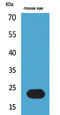 BCL2 Interacting Protein 3 antibody, STJ96519, St John