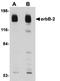 ERBB2 antibody, orb75194, Biorbyt, Western Blot image 