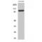 Proteasome 26S Subunit, Non-ATPase 2 antibody, LS-C385657, Lifespan Biosciences, Western Blot image 