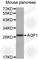 Aquaporin 1 (Colton Blood Group) antibody, A5868, ABclonal Technology, Western Blot image 