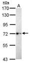 Brain Enriched Guanylate Kinase Associated antibody, GTX119786, GeneTex, Western Blot image 