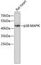 Mitogen-Activated Protein Kinase 13 antibody, 23-362, ProSci, Western Blot image 