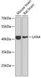 LIM Homeobox 4 antibody, GTX65966, GeneTex, Western Blot image 