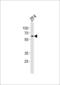 Calcium/Calmodulin Dependent Protein Kinase II Delta antibody, LS-C164312, Lifespan Biosciences, Western Blot image 