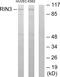 Ras And Rab Interactor 3 antibody, PA5-38743, Invitrogen Antibodies, Western Blot image 