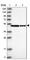 Spermine Synthase antibody, HPA029852, Atlas Antibodies, Western Blot image 