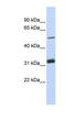 Tandem C2 Domains, Nuclear antibody, NBP1-55422, Novus Biologicals, Western Blot image 