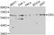 ETS Transcription Factor ERG antibody, A1240, ABclonal Technology, Western Blot image 