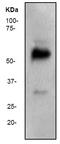 WT1 Transcription Factor antibody, ab89901, Abcam, Western Blot image 